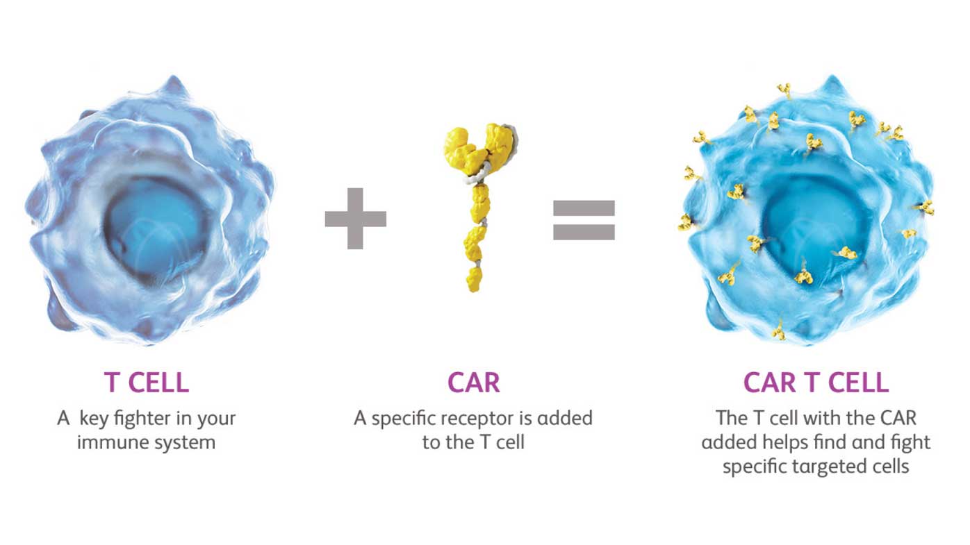 CAR-T Therapy Diagram